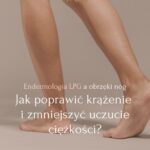 Endermologia LPG a obrzęki nóg – jak poprawić krążenie i zmniejszyć uczucie ciężkości