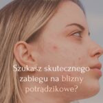 Szukasz skutecznego zabiegu na blizny Sprawdź, dlaczego warto wybrać VIVACE