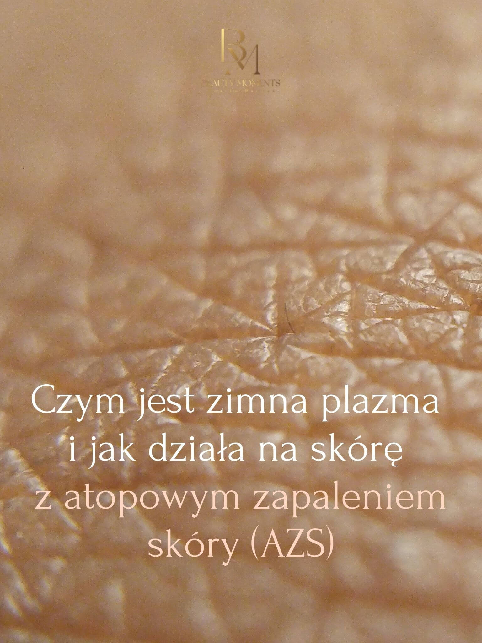 Czym jest zimna plazma i jak działa na skórę z atopowym zapaleniem skóry (AZS)