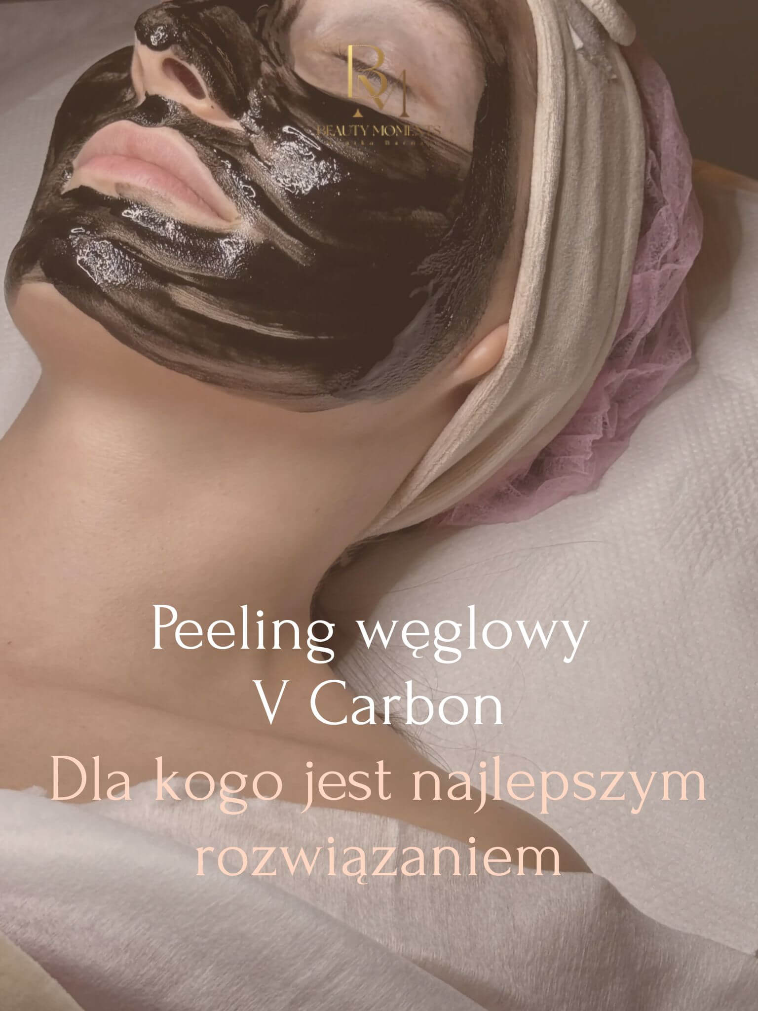 Blog 6 Peeling węglowy V Carbon – dla kogo jest najlepszym rozwiązaniem i jakie daje efekty