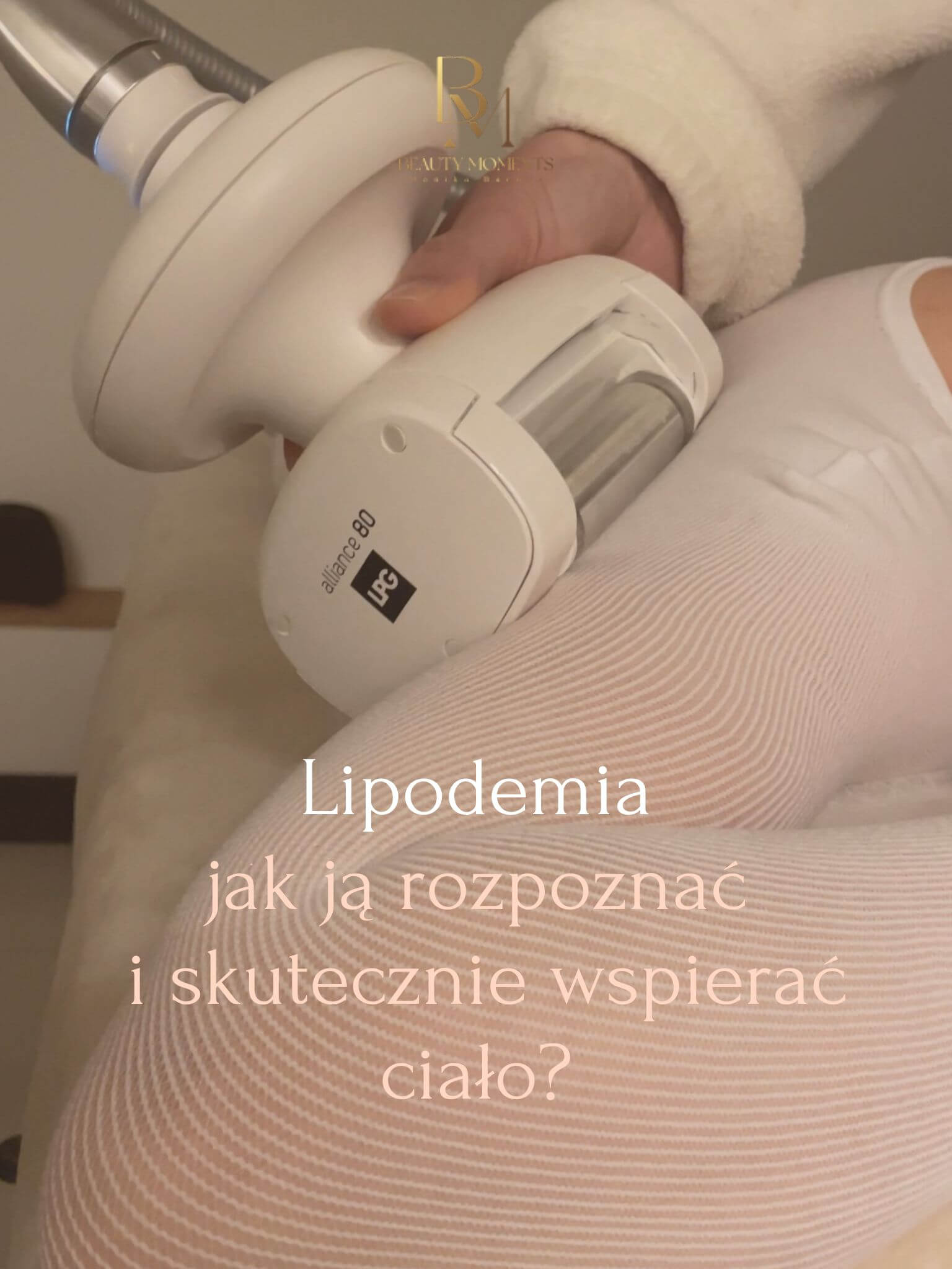 Blog 5 Lipodemia – jak ją rozpoznać i skutecznie wspierać ciało