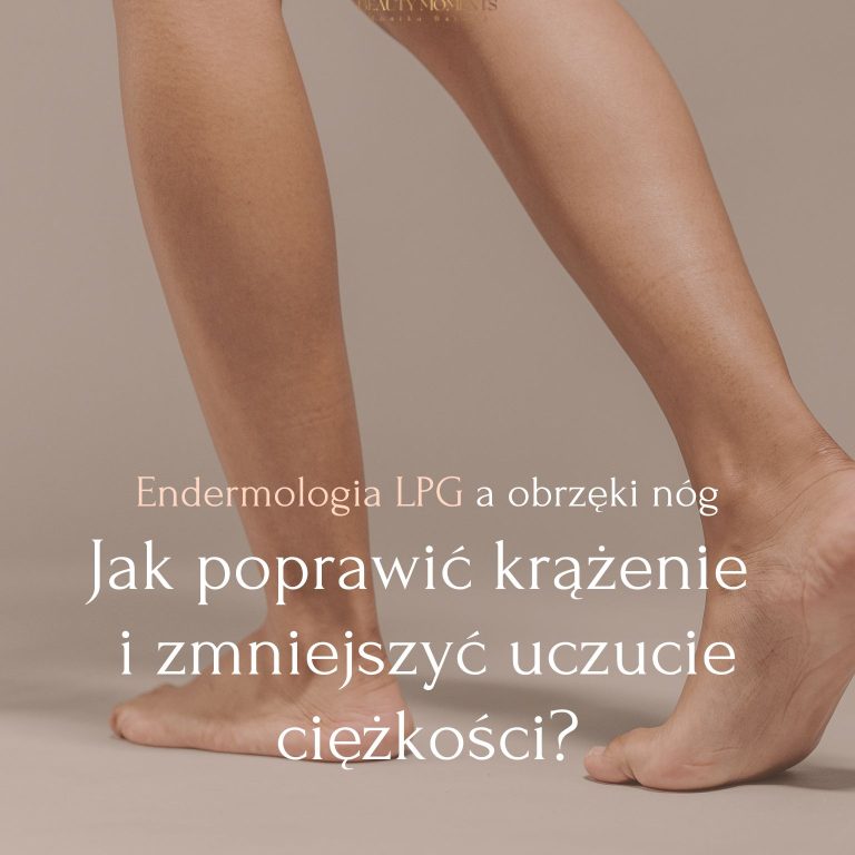 Endermologia LPG a obrzęki nóg – jak poprawić krążenie i zmniejszyć uczucie ciężkości