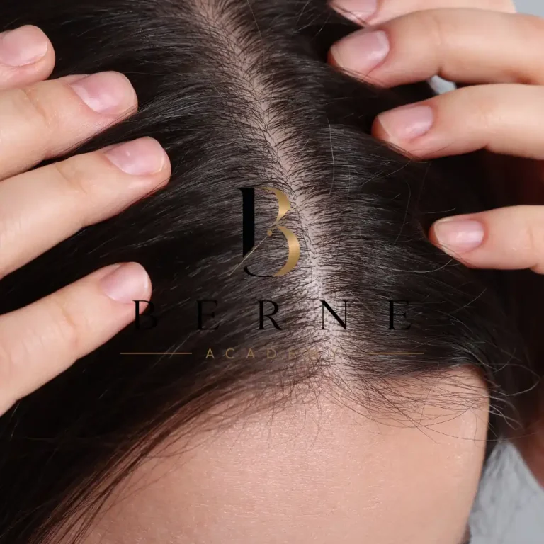 Mezoterapia Igłowa Skóry Głowy – Dr Cyj Hair
