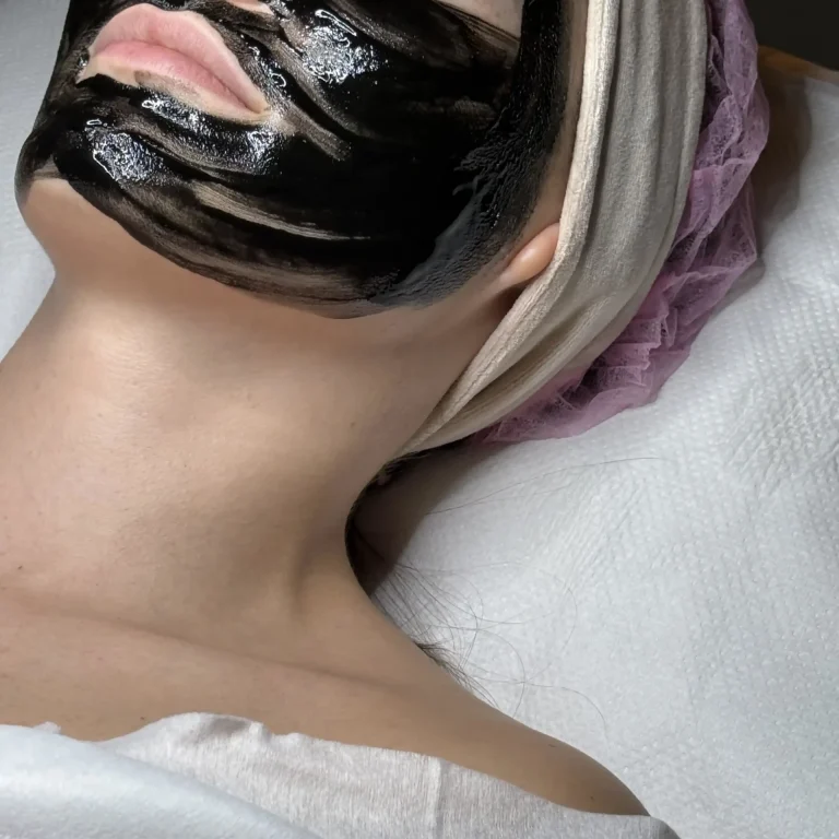Peeling węglowy V CARBON