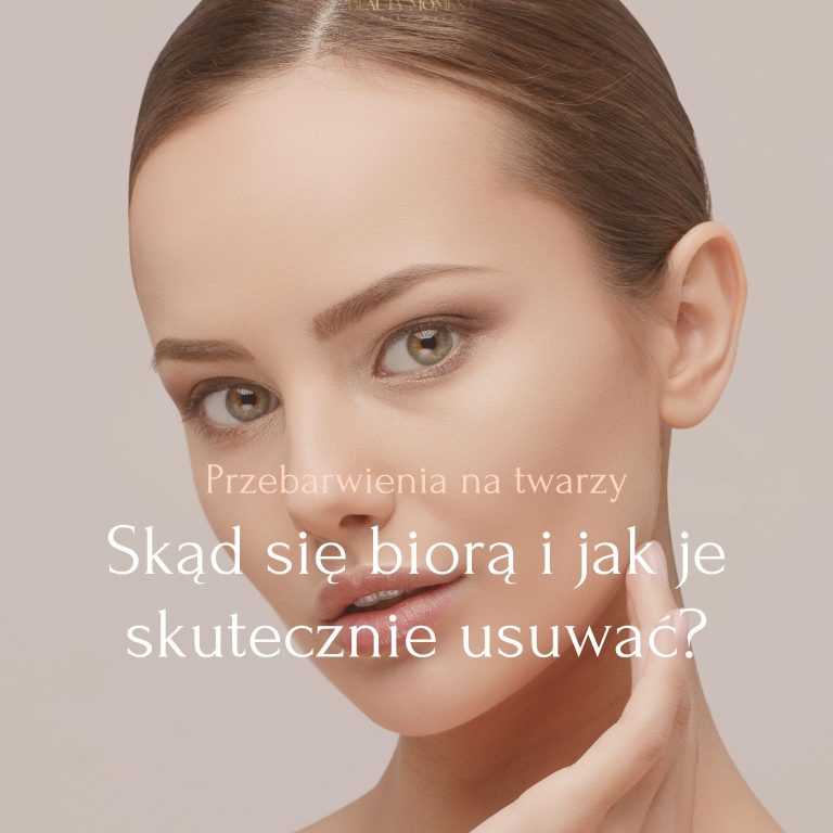 Przebarwienia na twarzy – skąd się biorą i jak je skutecznie usuwać