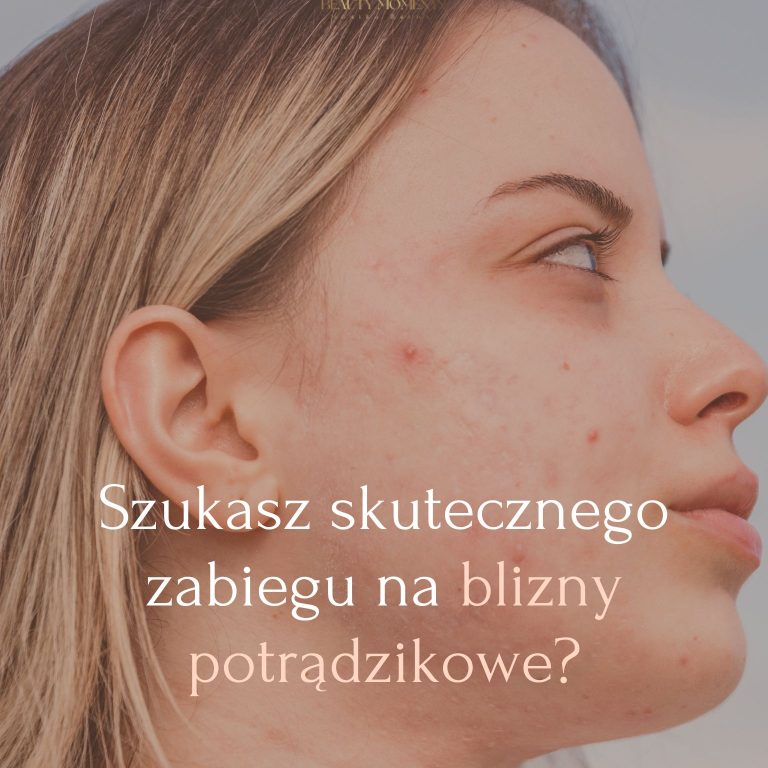 Szukasz skutecznego zabiegu na blizny Sprawdź, dlaczego warto wybrać VIVACE